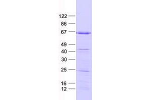 Western Blotting (WB) image for Zinc Finger Protein 354A (ZNF354A) protein (His tag) (ABIN2736012)