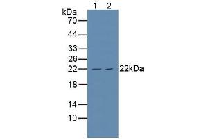 Figure. (TNFRSF1A 抗体  (AA 248-428))