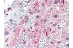 Image no. 1 for anti-Secreted phosphoprotein 1 (SPP1) (C-Term) antibody (ABIN372777) (Osteopontin 抗体  (C-Term))