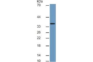 Mouse Capture antibody from the kit in WB with Positive Control:  Human heart lysate. (CTGF ELISA 试剂盒)