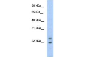 Western Blotting (WB) image for anti-Cytoplasmic Polyadenylated Homeobox (CPHX) antibody (ABIN2461548) (CPHX 抗体)