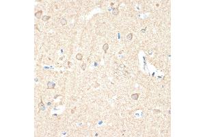 Immunohistochemistry of paraffin-embedded human brain using Guanylyl Cyclase beta 1 (GUCY1B3) (GUCY1B3) Rabbit mAb (ABIN7267551) at dilution of 1:100 (40x lens). (GUCY1B3 抗体)