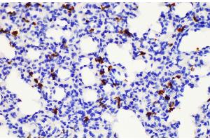Immunohistochemistry of paraffin-embedded Mouse lung using S100a8 Polycloanl Antibody at dilution of 1:200 (S100A8 抗体)