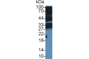 Detection of PGLYRP1 in Mouse Thymus lysate using Polyclonal Antibody to Peptidoglycan Recognition Protein 1 (PGLYRP1) (PGLYRP1 抗体  (AA 19-182))