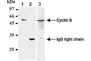 Western Blotting (WB) image for anti-Cyclin E1 (CCNE1) antibody (ABIN567784) (Cyclin E1 抗体)