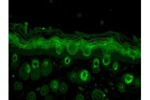 Immunohistochemistry (IHC) image for anti-RAB5A, Member RAS Oncogene Family (RAB5A) antibody (ABIN361846)