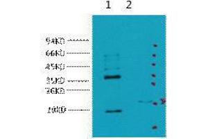 Western Blot (WB) analysis of 1) HeLa, 2) 293T, diluted at 1:5000. (CA9 抗体)