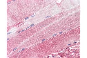 Anti-RAPSN / RAPSYN antibody IHC of human skeletal muscle. (RAPSN 抗体  (AA 395-412))