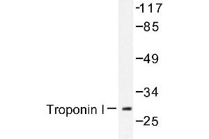 Image no. 1 for anti-Cardiac Troponin I (TNNI3) antibody (ABIN272087) (TNNI3 抗体)