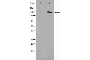 Western blot analysis on COLO205 cell lysate using MN1 Antibody,The lane on the left is treated with the antigen-specific peptide. (Meningioma 1 抗体  (Internal Region))