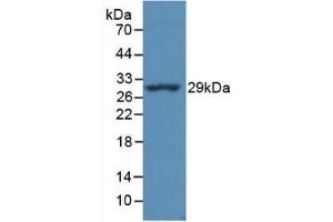 Detection of Recombinant MHCDRa, Simian using Monoclonal Antibody to HLA Class II Histocompatibility Antigen, DR Alpha Chain (HLA-DRA) (HLA-DRA 抗体  (AA 28-232))