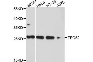 Western blot analysis of extracts of various cell lines, using TPD52 antibody.