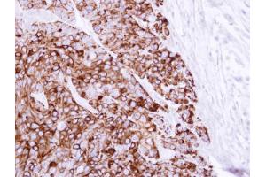 IHC-P Image Immunohistochemical analysis of paraffin-embedded HT29 xenograft, using Cytokeratin 20, antibody at 1:100 dilution. (KRT20 抗体)