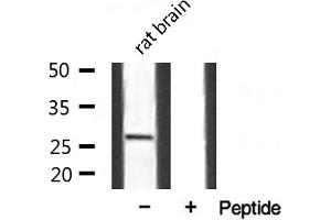 Western blot analysis of extracts from mouse Brian, using SPIC antibody. (SPIC 抗体  (Internal Region))