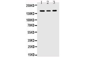 Anti-VEGF Receptor 1 antibody, Western blotting Lane 1: MCF-7 Cell Lysate Lane 2: SGC Cell Lysate Lane 3: MM231 Cell Lysate (FLT1 抗体  (C-Term))