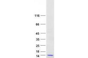 Western Blotting (WB) image for Vitamin K Epoxide Reductase Complex, Subunit 1 (VKORC1) (Transcript Variant 2) protein (Myc-DYKDDDDK Tag) (ABIN2735381)