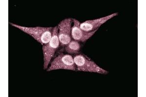 Immunofluorescent staining of HeLa cells. (RAN 抗体  (AA 7-171))
