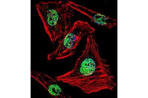 Fluorescent confocal image of Hela cell stained with ZBTB7B Antibody . (ZBTB7B 抗体  (C-Term))