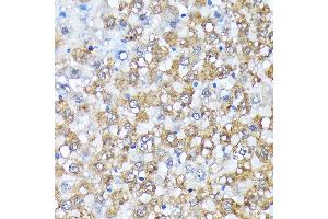 Immunohistochemistry of paraffin-embedded rat liver using Casein Kinase 1 alpha (Casein Kinase 1 alpha (CSNK1)) Rabbit mAb (ABIN7266098) at dilution of 1:100 (40x lens). (CSNK1A1 抗体)
