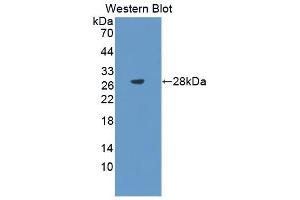 Detection of Recombinant CHRDL1, Mouse using Polyclonal Antibody to Chordin Like Protein 1 (CHRDL1) (CHRDL1 抗体  (AA 272-447))