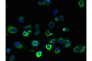 Immunofluorescent analysis of MCF-7 cells using ABIN7165422 at dilution of 1:100 and Alexa Fluor 488-congugated AffiniPure Goat Anti-Rabbit IgG(H+L) (FAM156A 抗体  (AA 1-153))