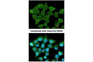 ICC/IF Image Immunofluorescence analysis of methanol-fixed A431, using SUCLA2, antibody at 1:200 dilution. (SUCLA2 抗体)