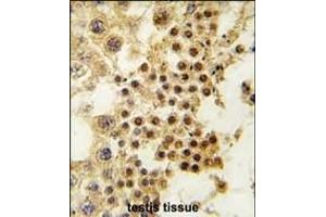 Formalin-fixed and paraffin-embedded human testis tissue reacted with GDF3 antibody (Center) (ABIN388819 and ABIN2839137) , which was peroxidase-conjugated to the secondary antibody, followed by DAB staining. (GDF3 抗体  (AA 170-197))