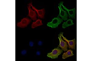 ABIN6262540 and ABIN6278895 staining Hela cells by IF/ICC. (IL17F 抗体  (Internal Region))