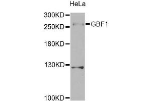 Western blot analysis of extracts of HeLa cells, using GBF1 Antibody. (GBF1 抗体)