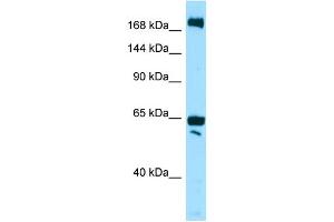 WB Suggested Anti-WNK2 Antibody Titration: 1. (WNK2 抗体  (N-Term))