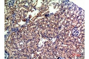 Immunohistochemistry (IHC) image for anti-Glycophorin A (GYPA) (Internal Region) antibody (ABIN7186185)