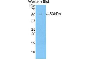 Western Blotting (WB) image for anti-Transglutaminase 1, Keratinocyte (TGM1) (AA 504-737) antibody (ABIN1860737)