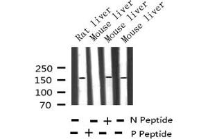 Western blot analysis of Phospho-EGFR (Thr678) expression in various lysates (EGFR 抗体  (pThr678))