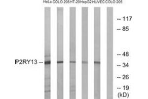 Western blot analysis of extracts from HeLa/COLO/HT-29/HepG2/HuvEc cells, using P2RY13 Antibody. (Purinergic Receptor P2Y, G-Protein Coupled, 13 (P2RY13) (AA 209-258) 抗体)