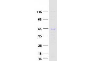 Validation with Western Blot