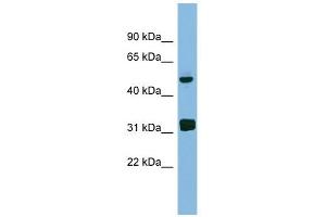 LYAR antibody used at 1 ug/ml to detect target protein. (LYAR 抗体)
