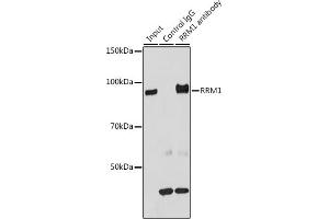 Immunoprecipitation analysis of 200 μg extracts of HT-29 cells using 3 μg RRM1 antibody (ABIN3021562, ABIN3021563, ABIN3021564 and ABIN6215245).