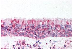 Immunohistochemistry (Formalin/PFA-fixed paraffin-embedded sections) of human trachea tissue with TRPV4 polyclonal antibody . (TRPV4 抗体  (N-Term))