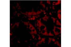Immunofluorescence of STEAP2 in Human Colon cells with STEAP2 Antibody  at 20 µg/ml. (STEAP2 抗体  (C-Term))