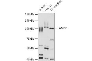 Western blot analysis of extracts of various cell lines, using L antibody (ABIN6129969, ABIN6143081, ABIN6143082 and ABIN6218224) at 1:1000 dilution.