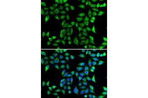 Immunofluorescence analysis of U20S cell using DNAJA3 antibody. (DNAJA3 抗体)