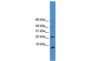 Image no. 1 for anti-Prostate Stem Cell Antigen (PSCA) (AA 51-100) antibody (ABIN6745361) (PSCA 抗体  (AA 51-100))