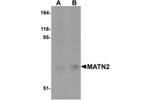 Western Blotting (WB) image for anti-Matrilin 2 (MATN2) (C-Term) antibody (ABIN1030508) (MATN2 抗体  (C-Term))