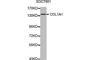 Western blot analysis of extracts of SGC7901 cell line, using COL1A1 antibody. (COL1A1 抗体)