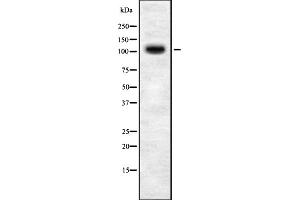Western Blotting (WB) image for anti-Topoisomerase I Binding, arginine/serine-Rich, E3 Ubiquitin Protein Ligase (TOPORS) (C-Term) antibody (ABIN6259220)