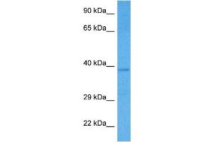 Host:  Rabbit  Target Name:  SMARCB1  Sample Tissue:  Human HCT15 Whole Cell lysates  Antibody Dilution:  1ug/ml (SMARCB1 抗体  (Middle Region))