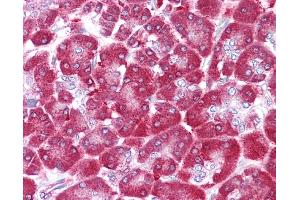 Immunohistochemistry (IHC) image for anti-Non-Metastatic Cells 1, Protein (NM23A) Expressed in (NME1) (N-Term) antibody (ABIN2792090)