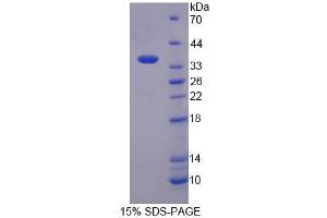 SDS-PAGE analysis of Human EEF1a2 Protein. (EEF1A2 蛋白)