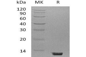 Western Blotting (WB) image for Complement Component 5 (C5) protein (ABIN7320495) (C5 蛋白)
