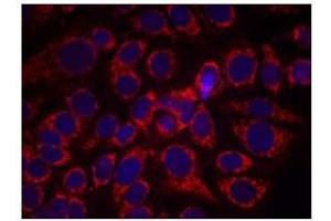 Immunofluorescence staining of methanol-fixed MCF7 cells using CD340 / ERBB2 / HER2 Antibody (pTyr1248) (ErbB2/Her2 抗体  (pTyr1248))